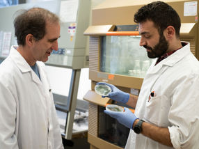 Unexpected discovery: Blue-green algae produce oil