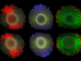 Bacterial glitter: New findings open up possibilities for sustainable color technologies